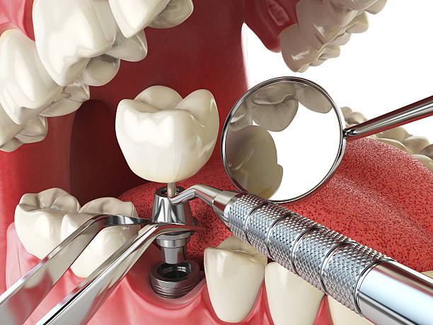 Best Emergency Dental Care for Trauma or Injury in Victoria, VA
